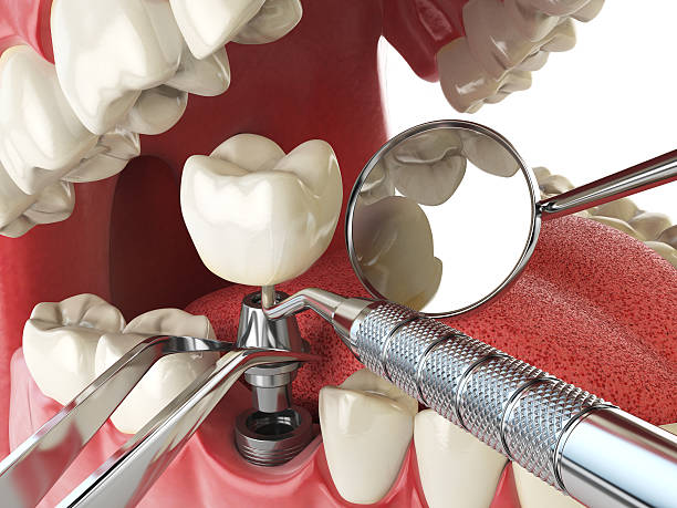 Best After-Hours Emergency Dentist in Mechanicsburg, OH