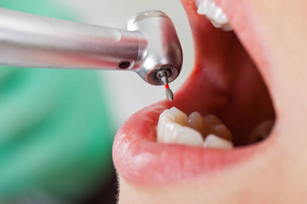 Best Emergency Dental Care for Trauma or Injury in Mechanicsburg, OH